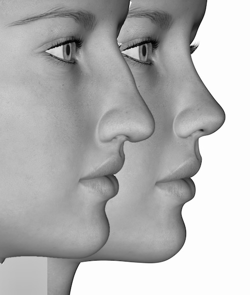 Breast shape mimics nose shape : r/badwomensanatomy
